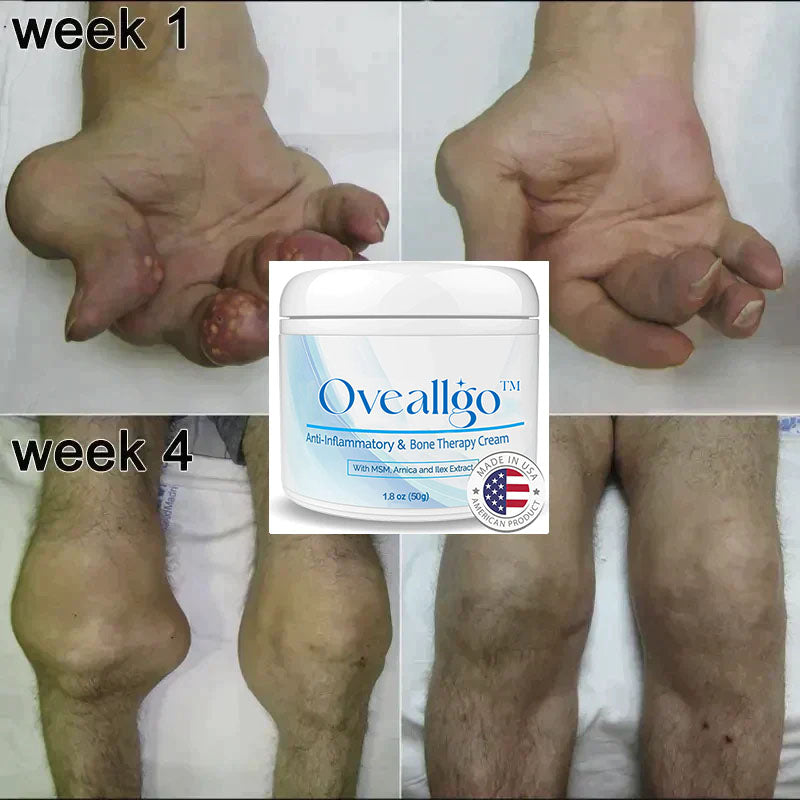 Oveallgo™ Joint & Bone Therapy Cream