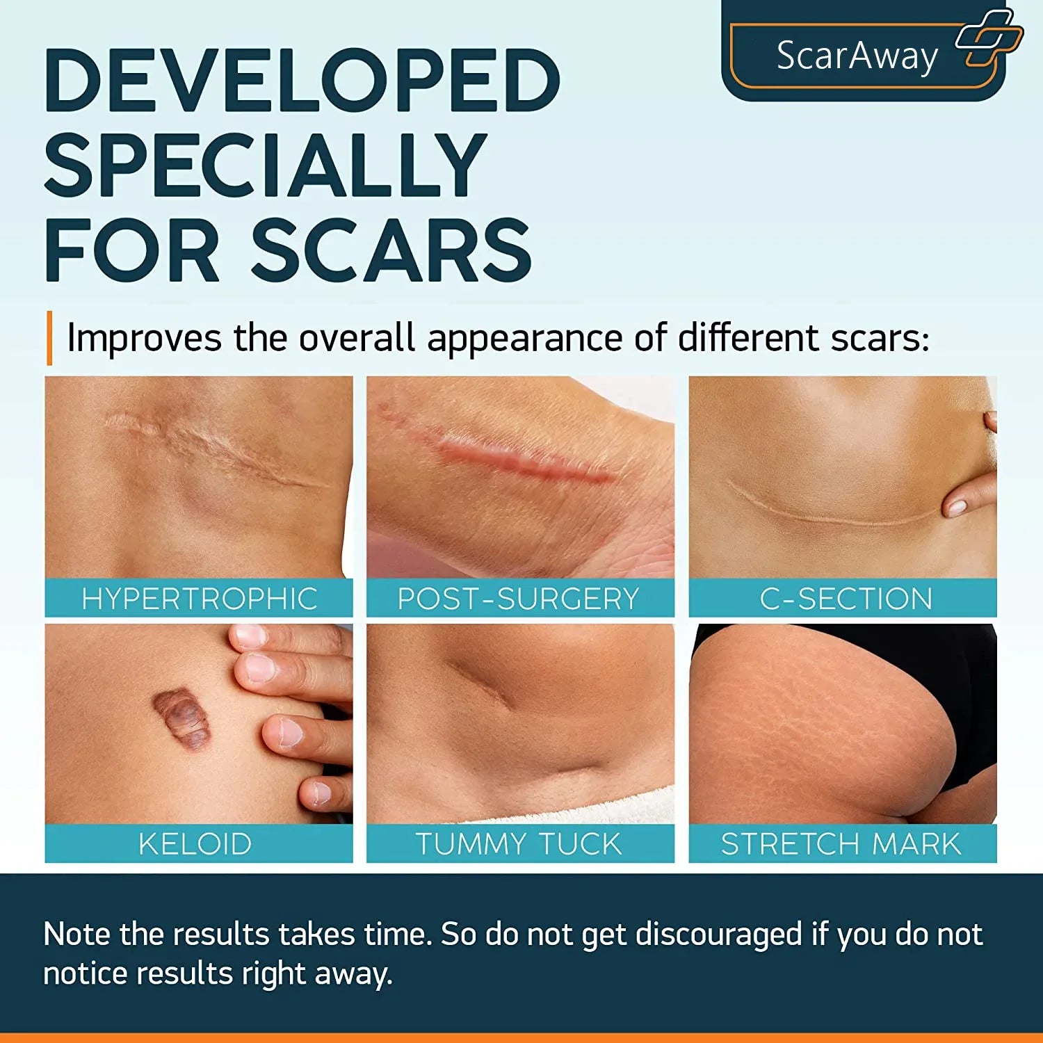 ScarAway® Advanced Scar Gel