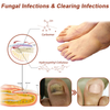 Load image into Gallery viewer, Oveallgo™ NanoPRO Revolutionary High-Efficiency Light Therapy Device For Toenail Diseases