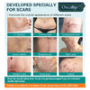 Load image into Gallery viewer, Oveallgo™ Advanced Scar Removal Spray