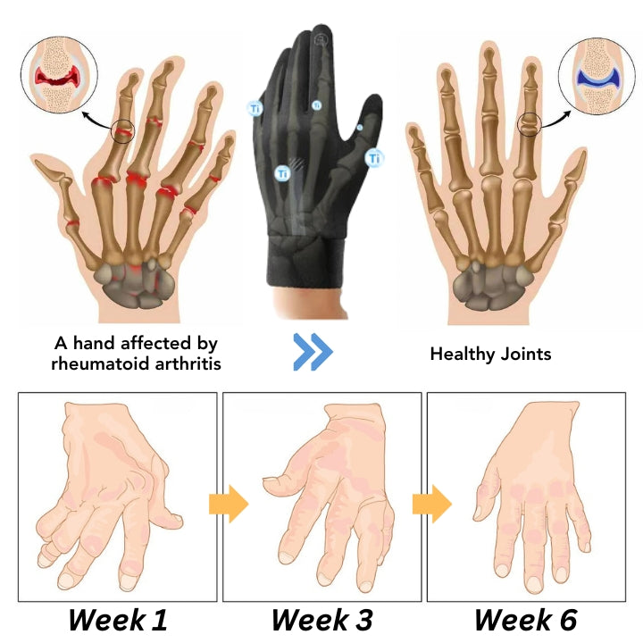 Oveallgo™ IONHEAT Joint and Bone Therapy Gloves