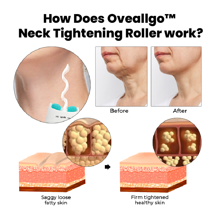 Oveallgo™ Neck Tightening Roller
