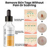 Load image into Gallery viewer, Oveallgo™ Advanced Skin Tag Clearing Essence