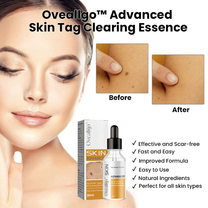 Oveallgo™ Advanced Skin Tag Clearing Essence