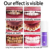 Load image into Gallery viewer, Oveallgo™ Deluxe Herbal Teeth Whitening Mousse