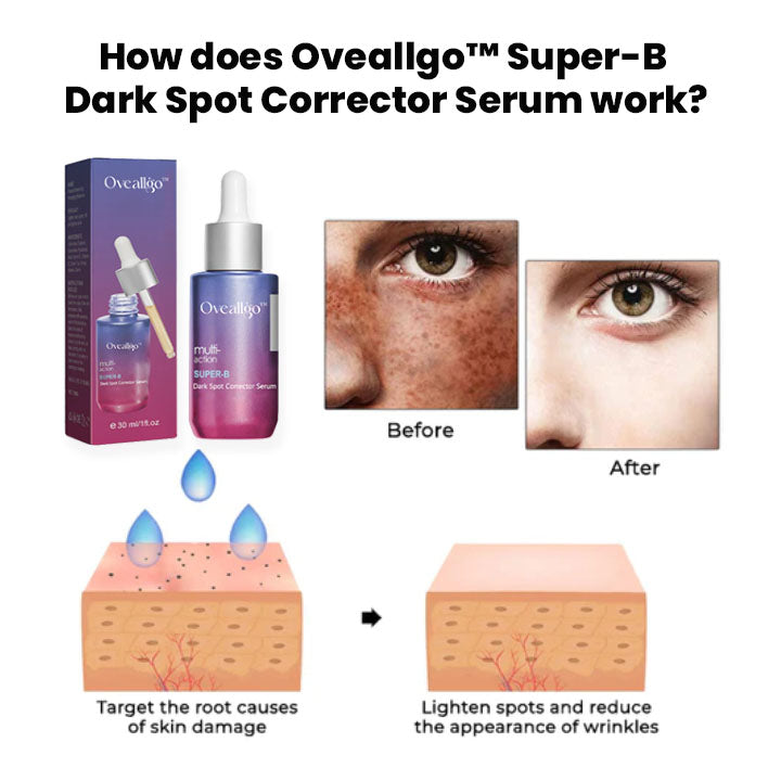 Oveallgo™ Super-B Dark Spot Corrector Serum